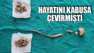 30 SANTİMLİK TAŞTAN KURTULDU