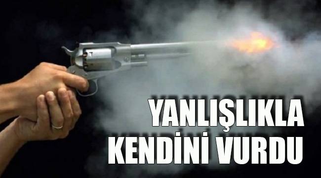 YANLIŞLIKLA KENDİNİ VURDU