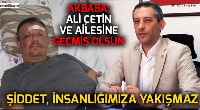 Akbaba; Ali Çetin ve ailesine geçmiş olsun