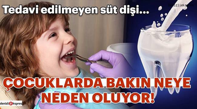 Çocuklarda tedavi edilmeyen süt dişi bakın nelere neden oluyor