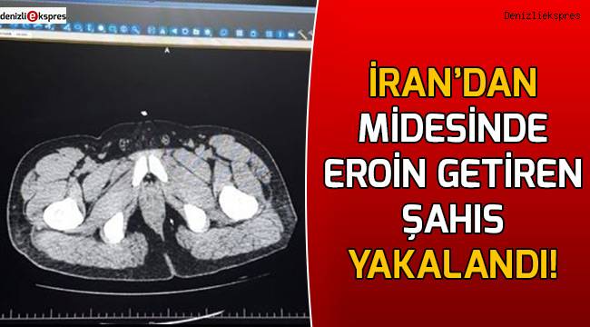 İran’dan midesinde eroin getiren şahıs yakalandı!