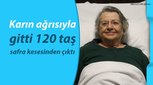 Karın ağrısıyla gitti, safra kesesinden 120 taş çıktı