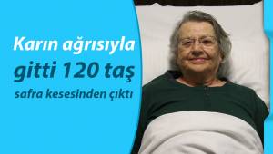 Karın ağrısıyla gitti, safra kesesinden 120 taş çıktı