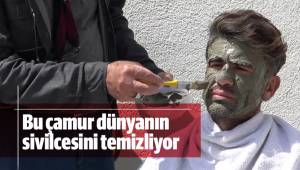 Bu çamur dünyanın sivilcesini temizliyor