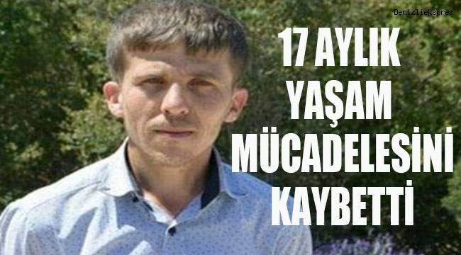 17 Aylık yaşam mücadelesini kaybetti