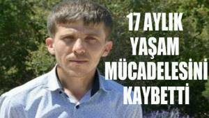17 Aylık yaşam mücadelesini kaybetti