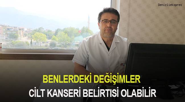 Benlerdeki değişimler cilt kanseri belirtisi olabilir