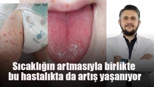 Sıcaklığın artmasıyla birlikte bu hastalıkta da artış yaşanıyor