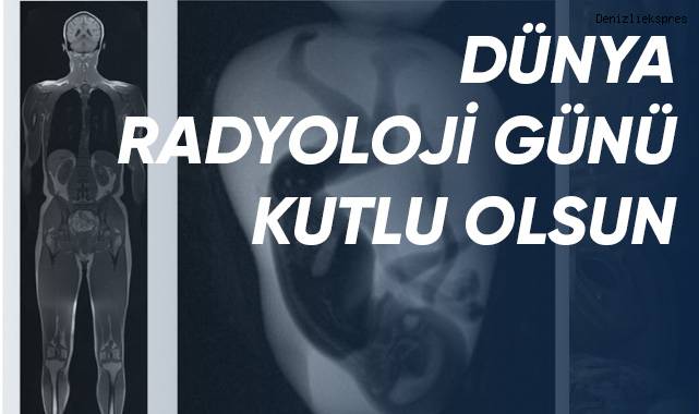 Dünya Radyoloji Günü kutlu olsun