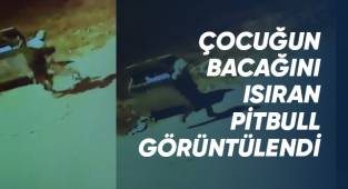 Çocuğun bacağını ısıran pitbull görüntülendi