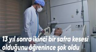 13 yıl sonra ikinci bir safra kesesi olduğunu öğrenince şok oldu