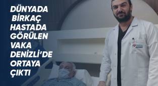 Dünyada sayılı görülen vaka Denizli’de ortaya çıktı