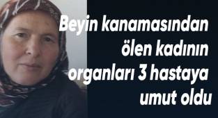 Beyin kanamasından ölen kadın 3 hastaya umut oldu