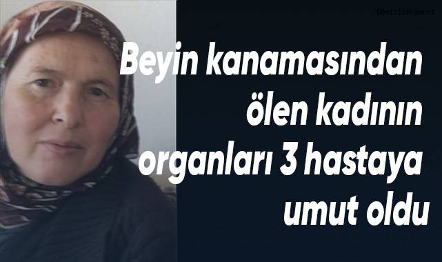 Beyin kanamasından ölen kadın 3 hastaya umut oldu
