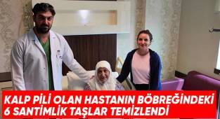 Kalp pili olan hastanın böbreğindeki 6 santimlik taşlar temizlendi