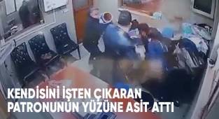 Termos dolusu asidin hedefi olan fabrikatörün 1 gözünde yüzde 90 kayıp oluştu