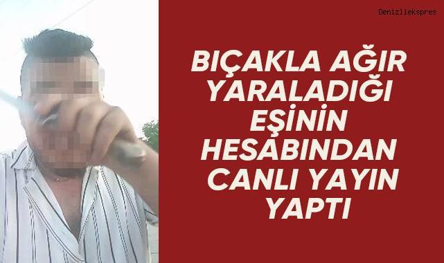 Bıçakla ağır yaraladığı eşinin hesabından canlı yayın yaptı