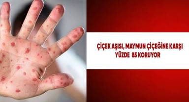 Çiçek aşısı, maymun çiçeğine karşı yüzde 85 koruyor
