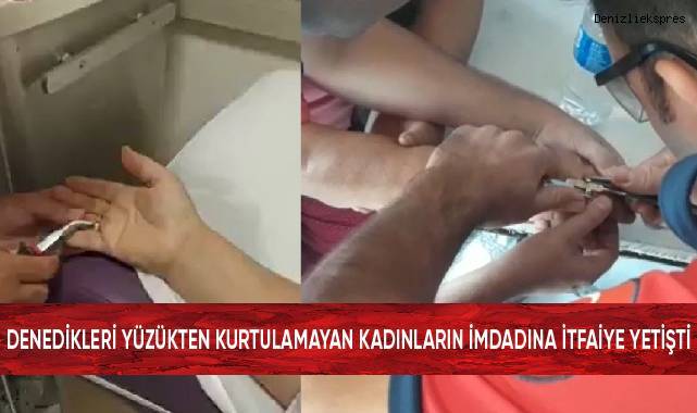 Denedikleri yüzüklerden kurtulamayan kadınların imdadına itfaiye yetişti