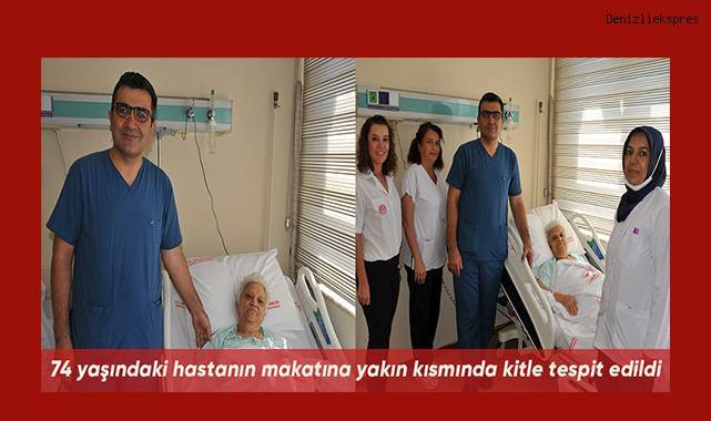 74 yaşındaki hastanın makatına yakın kısmında kitle tespit edildi