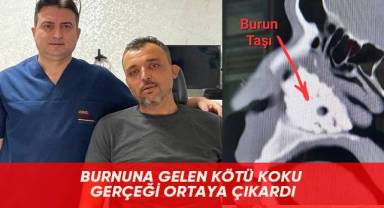 Burnuna gelen kötü koku gerçeği ortaya çıkardı