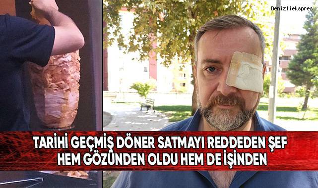 Tarihi geçmiş döner satmayı reddeden şef hem gözünden hem de işinden oldu