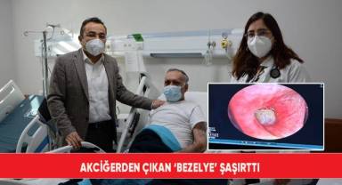 Akciğerden çıkan ‘bezelye’ şaşırttı