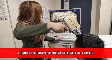 Demir ve Vitamin Eksikliği Kelliğe Yol Açıyor