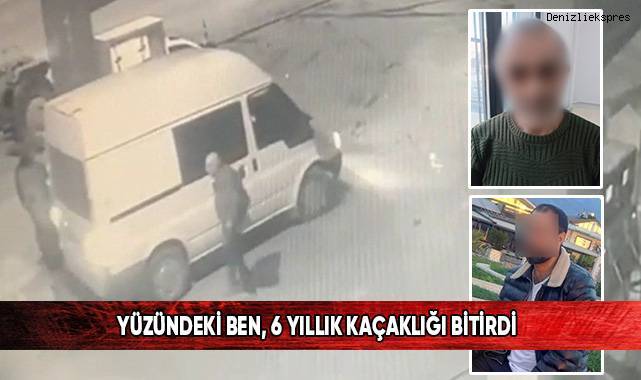 Son hırsızlık vurgununda yakalandı, yüzündeki ben tüm foyasını ortaya çıkardı