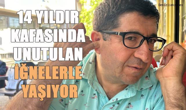 14 yıldır kafatasında unutulan iğnelerle yaşıyor