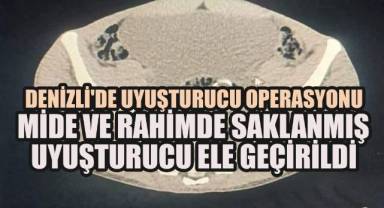 DENİZLİ'DE UYUŞTURUCU OPERASYONU: MİDE VE RAHİMDE SAKLANMIŞ 320 GRAM MADDE ELE GEÇİRİLDİ