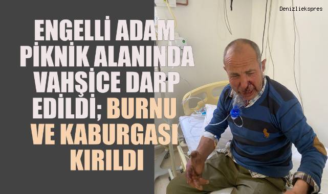 Engelli Adam Piknik Alanında Vahşice Darp Edildi, Burnu ve Kaburgası Kırıldı