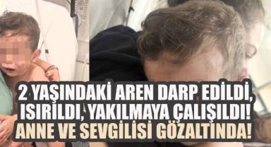 2 yaşındaki Aren darp edildi, ısırıldı, yakılmaya çalışıldı! Anne ve sevgilisi gözaltında!