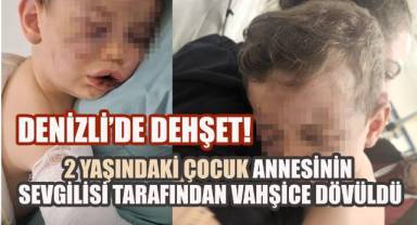 Denizli'de 2 yaşındaki çocuk annesinin sevgilisi tarafından vahşice dövüldü
