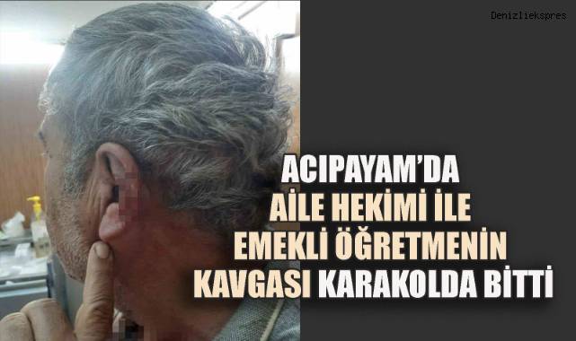 Acıpayam’da Aile Hekimi ile Emekli Öğretmenin Kavgası Karakolda Bitti
