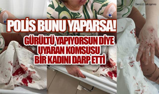 Polis Bunu Yaparsa… Sarayköy'de Kadına Coplu Saldırı